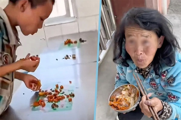 Bác sĩ sốc nặng khi lấy 56 vật kim loại ra khỏi bụng cậu bé 15 tuổi-2