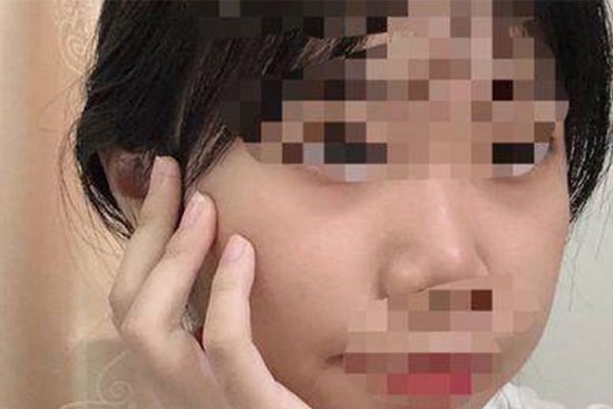 Áp lực học tập khiến nữ sinh cấp 3 Trung Quốc già nua như người 30 tuổi