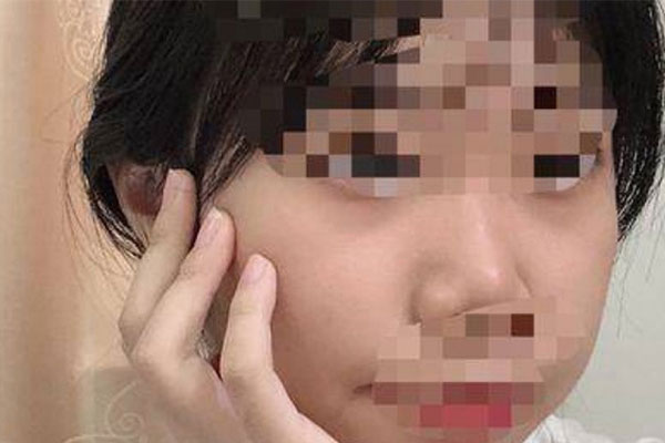 Áp lực học tập khiến nữ sinh cấp 3 Trung Quốc già nua như người 30 tuổi-1