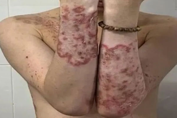 Nên ăn bao nhiêu nấm mỗi ngày?-2