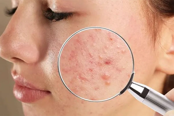 Đưa làn da mỏng manh đi qua mùa lạnh bằng cách hiểu tận tường về dưỡng ẩm-6