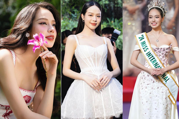 Cô gái mặt méo lột xác sau 3 cuộc đại phẫu-3