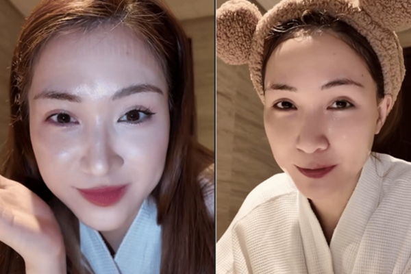 Hoà Minzy nhập viện cấp cứu-4