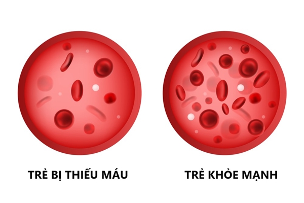 Bé trai 2 tuổi phải lọc máu liên tục sau 7 ngày được người lớn vệ sinh lưỡi-2