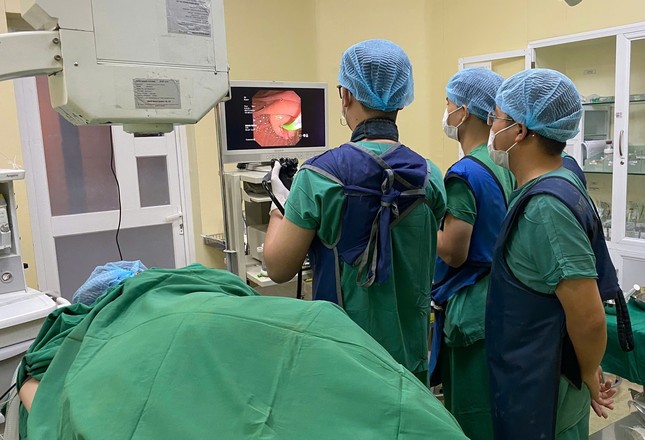 Phát hiện sán lá gan khủng trong ống mật cô gái trẻ-2