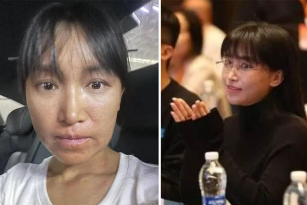 Lý Tử Thất xuất hiện sau bức ảnh gây sốc-3