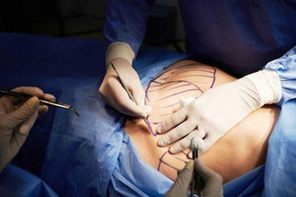 Bị hoại tử da vì hút mỡ bụng tại cơ sở quảng cáo qua mạng-2