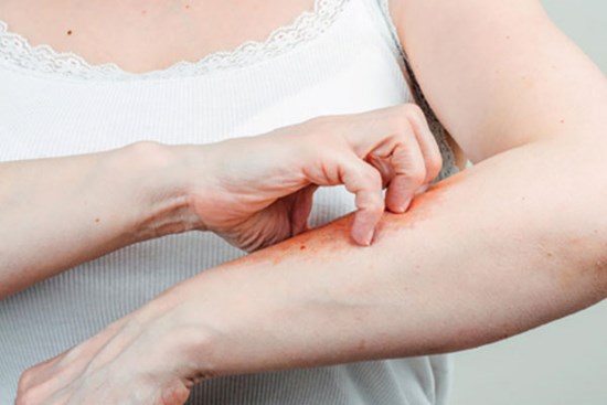 Cách khắc phục da khô, ngứa trong mùa đông