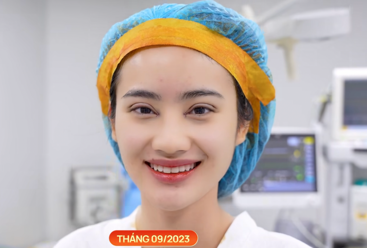 Hoa hậu Ý Nhi xinh đẹp hơn sau phẫu thuật thẩm mỹ nhưng netizen lại lo ngại một điểm-4