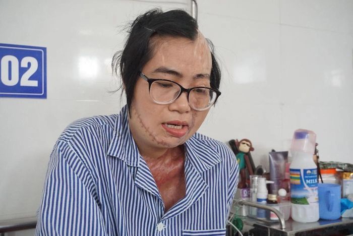 Nỗi đau của nữ giáo viên bị chồng tưới axit trước mặt con gái-1