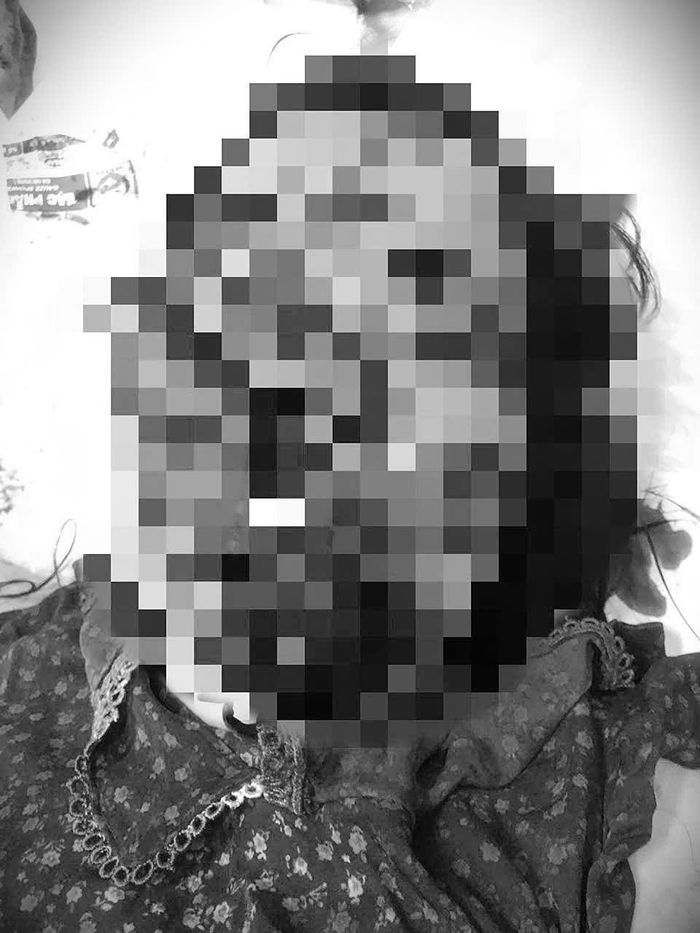 Tạm giữ người đàn ông chém nát mặt một phụ nữ nghi có quan hệ tình cảm-1