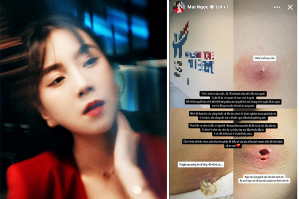 Sức khỏe MC Mai Ngọc sau 1 tuần vào viện-1