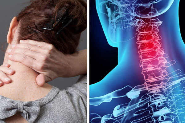 Hậu quả khôn lường từ thói quên bẻ, lắc cổ nhưng không phải ai cũng biết-1