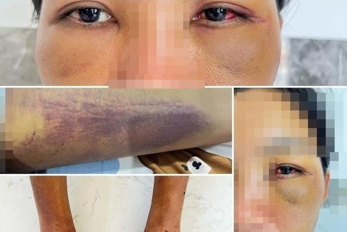 Ám ảnh của người phụ nữ bị gia đình chồng giam lỏng, ép ăn chất thải để trừ tà-2