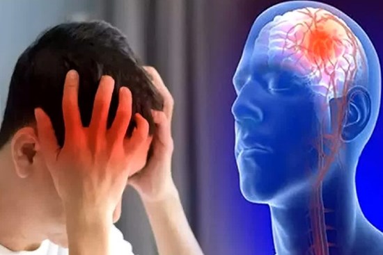 Chàng trai 26 tuổi bị đột quỵ, bác sĩ cảnh báo thói quen ăn uống nguy hiểm