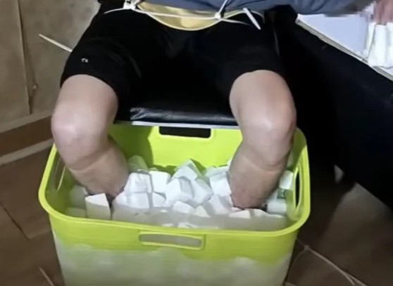 Nam thanh niên ngâm chân trong đá khô, tự hủy 2 chân vì lý do không ngờ-1