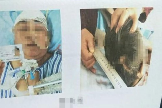 Thương tâm: Chứng kiến mẹ gặp tai nạn, con gái sốc đến mức liên tục hét 