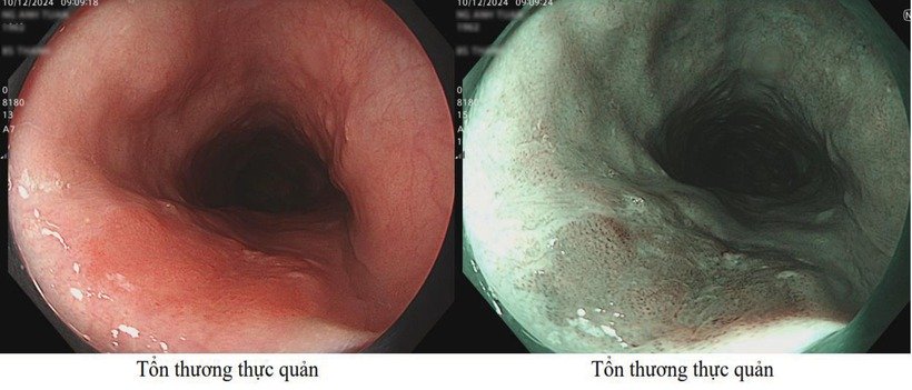 Người đàn ông tá hỏa phát hiện ung thư sau lần đi khám để yên tâm đón Tết”-1