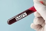 Biết gì về HMPV - virus đang lây ở Trung Quốc?