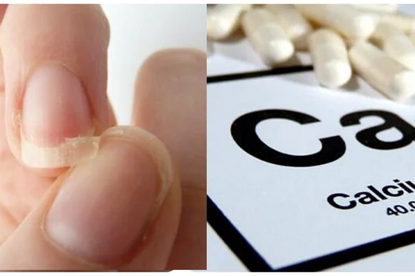 7 triệu chứng thiếu canxi ở người lớn-2