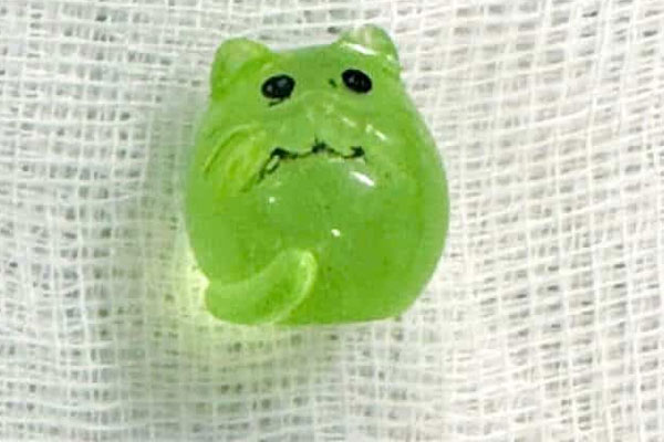 Cô gái 22 tuổi nhập viện cấp cứu vì sự cố ít ai gặp khi đi vệ sinh-2