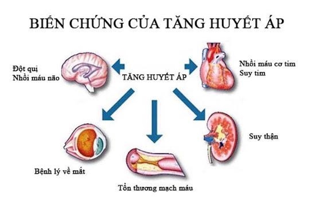 Người phụ nữ 35 tuổi ở Hà Nội bị suy thận, cao huyết áp thừa nhận một sai lầm nhiều người Việt mắc phải-2