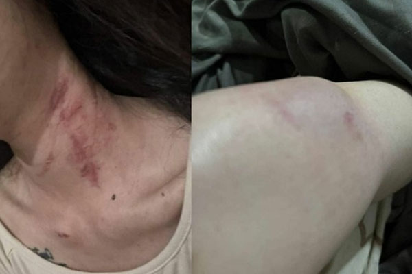 Dân mạng tranh cãi gay gắt trước lý do của người vợ tái hôn gã chồng vũ phu để rồi lại bị đánh đập-3