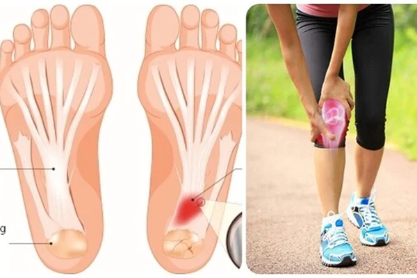 Đi bộ 6-6-6 có tác dụng gì?-2