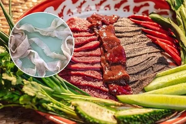 Tình trạng đáng sợ của nam bệnh nhân do thói quen xấu khi ăn thịt lợn-2