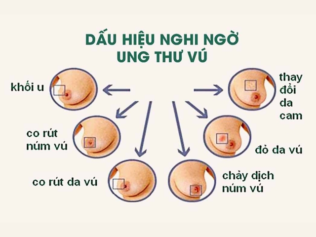 Dấu hiệu nhận biết căn bệnh Diva Hồng Nhung mắc phải, khuyến cáo chị em không được chủ quan-2