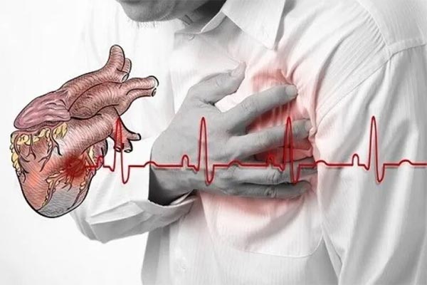 Người đàn ông ngừng tim 10 phút, cận kề cửa tử” vì một sai lầm cực hại tim khi tập thể dục-3