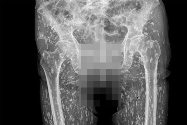 Thiếu hụt lớn thịt lợn, thương lái lùng mua với giá cao ngất ngưởng-2