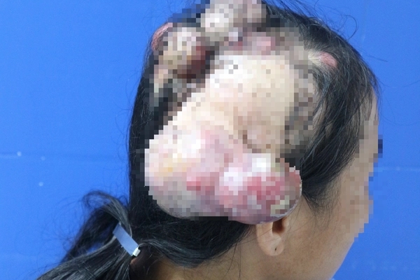 Đi khám vì đầy bụng, nữ sinh bàng hoàng nhận tin chỉ còn 1 tuần để sống-2