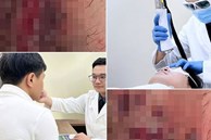 Bi hài chuyện 'dao kéo' đổi vận: Nghe thầy 'khai mở cung Quan lộc', trai trẻ suýt 'về chầu ông bà'