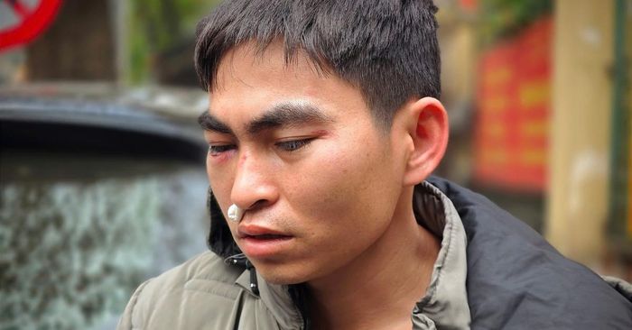 Khởi tố vụ án, tạm giữ hình sự tài xế ô tô Lexus đánh nam shipper-1