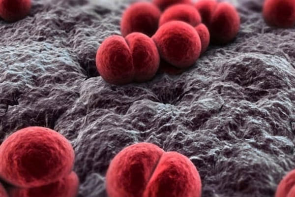 Mức độ nguy hiểm của viêm não mô cầu-3