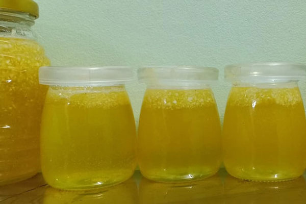 Người đàn ông ở Vĩnh Phúc mắc bệnh tiểu đường suy hô hấp, tổn thương phổi vì biến chứng cúm A-3