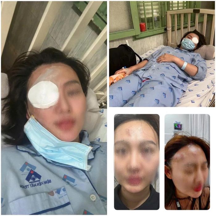 Khởi tố người hành hung bạn gái trong quán cà phê ở Bình Chánh-1