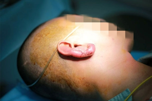 Bi hài chuyện dao kéo đổi vận: Người đàn ông suýt gặp ông bà vì giữ nốt ruồi phong thủy-4