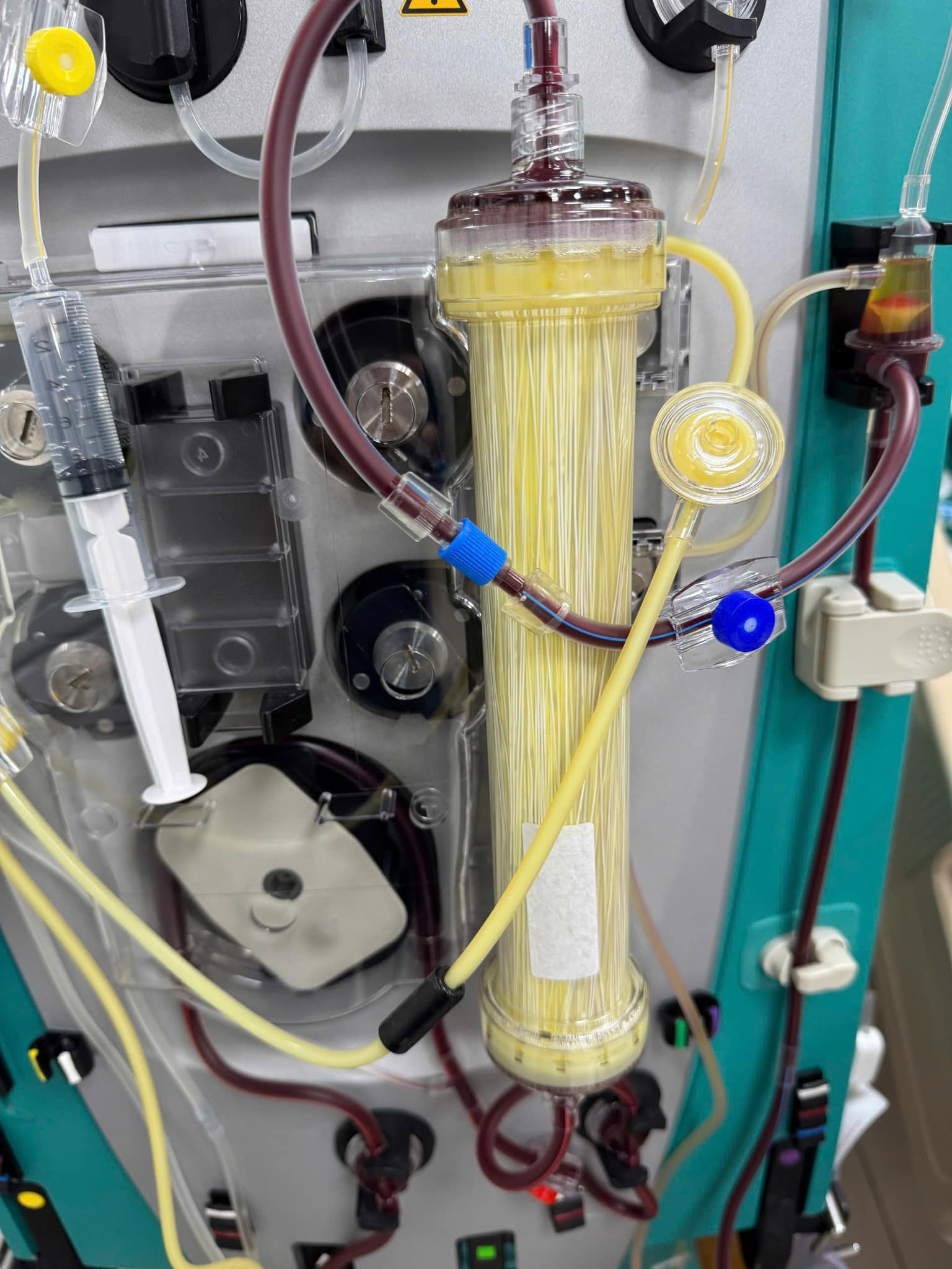 PGS Nguyễn Lân Hiếu phanh phui cú lừa lọc máu ngừa đột quỵ-1