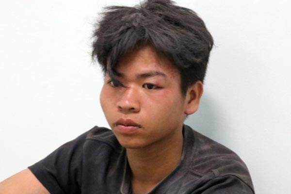 Vụ con đổ xăng đốt mẹ: Nạn nhân đoán lý do khiến con trai ra tay-2